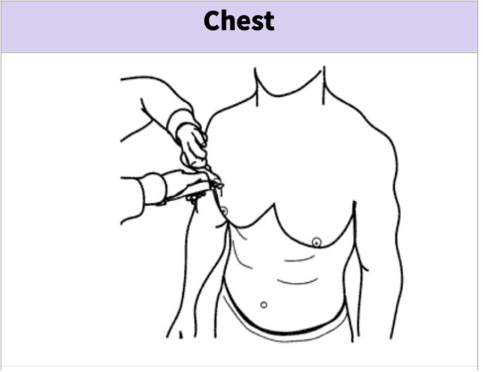 Chest