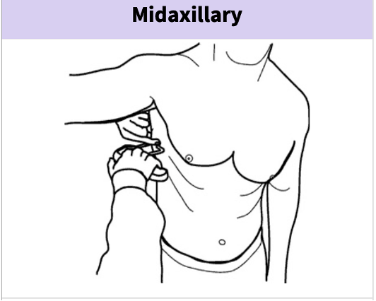 Middenrif